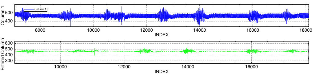 EMG captured with KST2